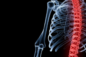 Spinal Cord Injuries: How They Happen and How to Heal